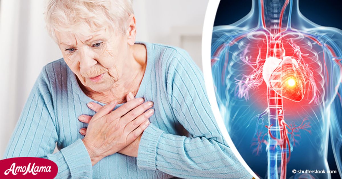 Infarto en mujeres: 8 síntomas y factores de riesgo