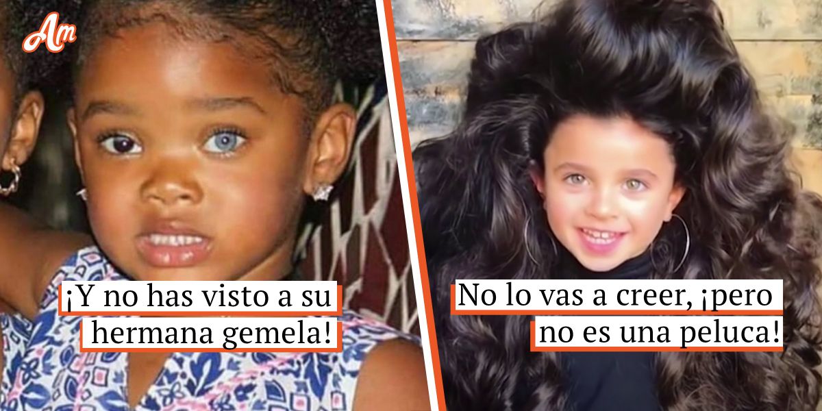 10 niños cuya inusual apariencia asombra a la gente en todo el mundo